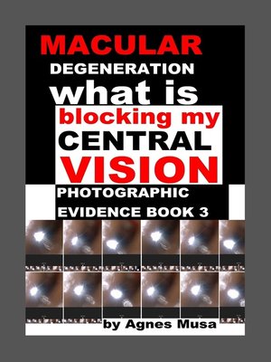 cover image of Macular Degeneration, What Is Blocking My Central Vision, Photographic Evidence Book 3